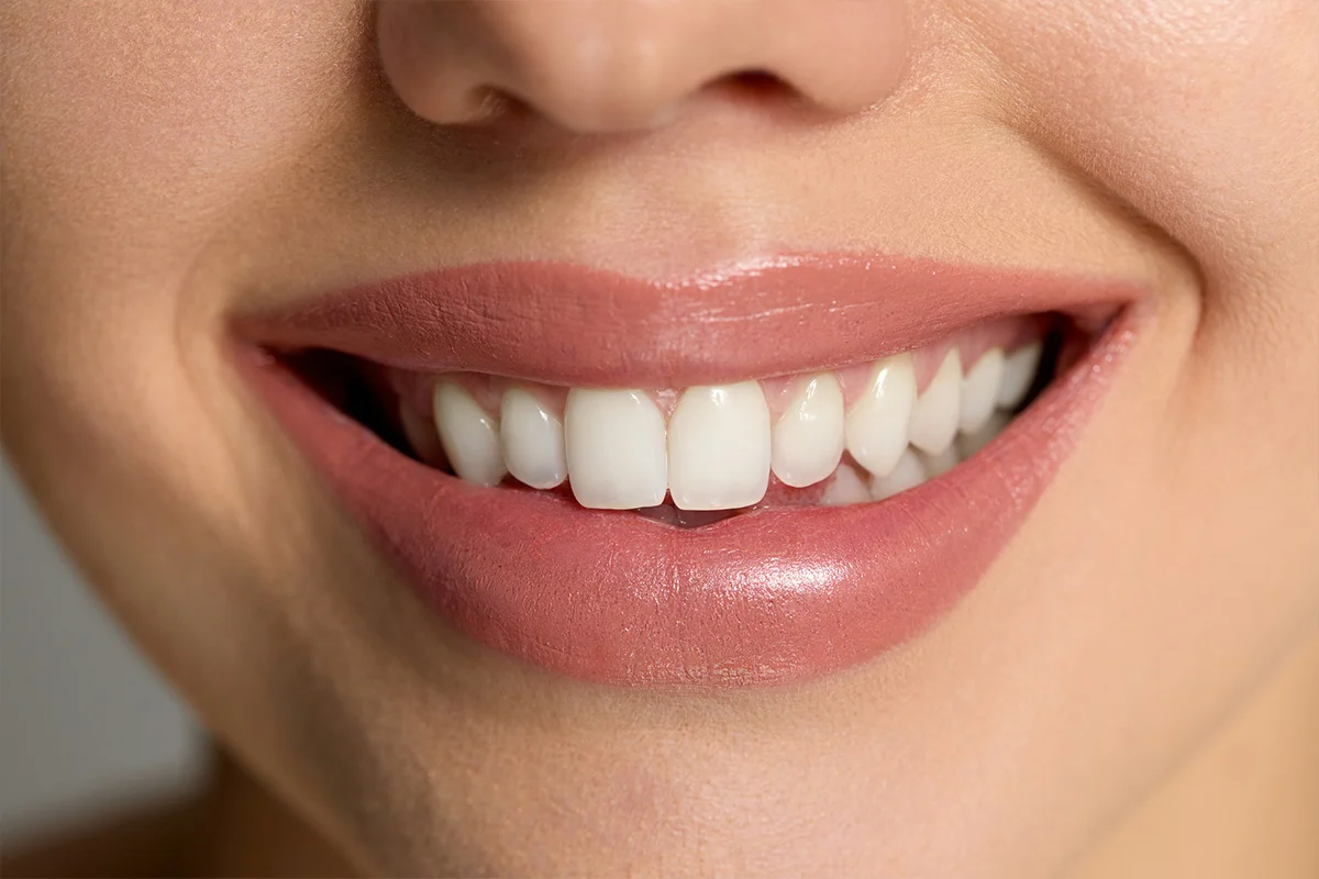 Trattamenti di estetica del sorriso presso Dental Marina a Savignano sul Rubicone