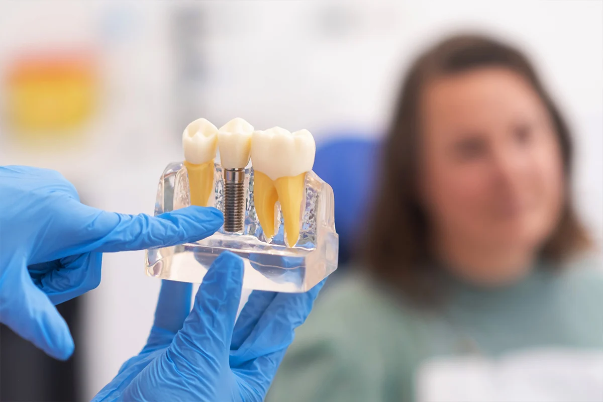 Implantologia e protesi dentale presso Dental Marina a Savignano sul Rubicone