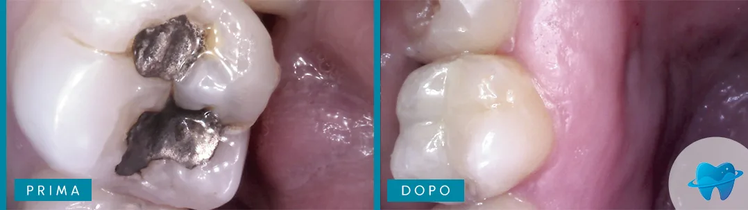 Caso Dental Marina prima e dopo