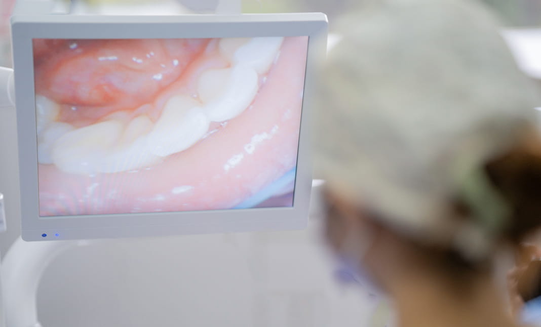 telecamera intraorale Dental Marina Savignano sul Rubicone